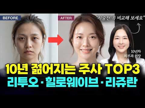 리쥬란 힐로웨이브 리투오 특징 비교하고 나에게 맞는 스킨부스터 찾기